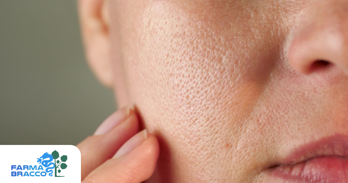 Come ridurre i pori dilatati: skincare e trattamenti